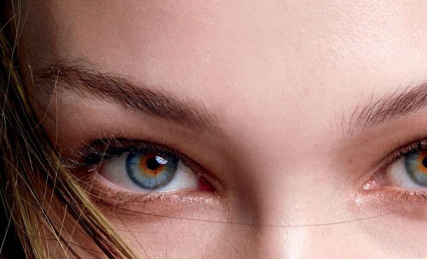 Fox Eye Surgery Turkey